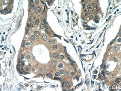 beta-Catenin Rabbit anti-Human, Mouse, Rat, Zebrafish, Polyclonal, Proteintech