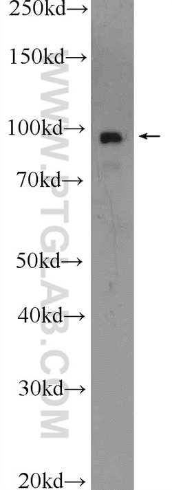 beta-Catenin Rabbit anti-Human, Mouse, Rat, Zebrafish, Polyclonal, Proteintech