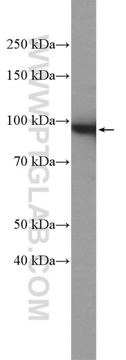 beta-Catenin Rabbit anti-Human, Mouse, Rat, Zebrafish, Polyclonal, Proteintech