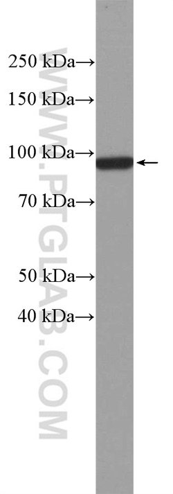 beta-Catenin Rabbit anti-Human, Mouse, Rat, Zebrafish, Polyclonal, Proteintech