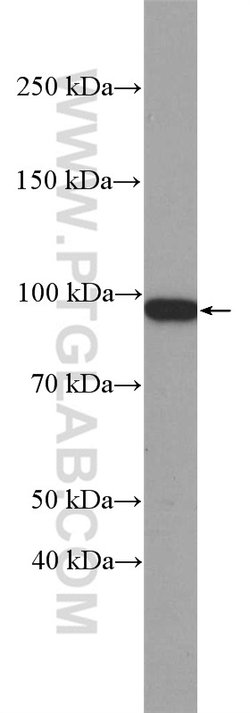beta-Catenin Rabbit anti-Human, Mouse, Rat, Zebrafish, Polyclonal, Proteintech