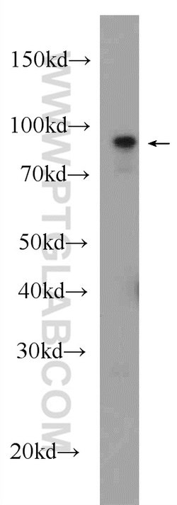 beta-Catenin Rabbit anti-Human, Mouse, Rat, Zebrafish, Polyclonal, Proteintech