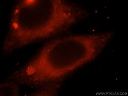 MAPK10 Rabbit anti-Human, Mouse, Rat, Polyclonal, Proteintech 150 &mu;L;