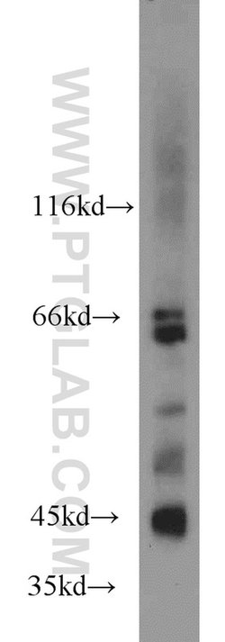 MAPK10 Rabbit anti-Human, Mouse, Rat, Polyclonal, Proteintech 150 &mu;L;