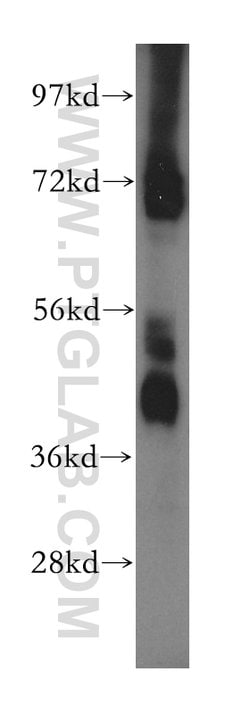 MAPK10 Rabbit anti-Human, Mouse, Rat, Polyclonal, Proteintech 150 &mu;L;