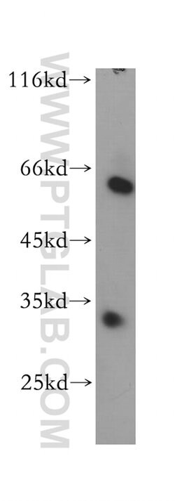 THNSL2 Rabbit anti-Human, Mouse, Rat, Polyclonal, Proteintech:Antibodies:Primary