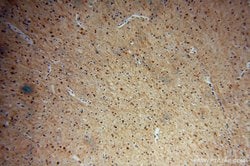 MDM1 Rabbit anti-Human, Mouse, Rat, Polyclonal, Proteintech 150 &mu;L;
