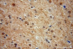 MDM1 Rabbit anti-Human, Mouse, Rat, Polyclonal, Proteintech 150 &mu;L;