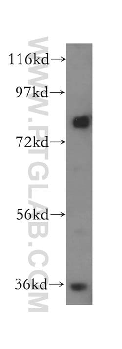 MDM1 Rabbit anti-Human, Mouse, Rat, Polyclonal, Proteintech 150 &mu;L;