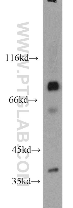 MDM1 Rabbit anti-Human, Mouse, Rat, Polyclonal, Proteintech 150 &mu;L;