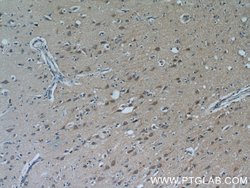 PYK2 Rabbit anti-Human, Mouse, Rat, Polyclonal, Proteintech 150 &mu;L;