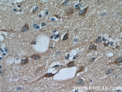 PYK2 Rabbit anti-Human, Mouse, Rat, Polyclonal, Proteintech 150 &mu;L;