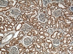 PYK2 Rabbit anti-Human, Mouse, Rat, Polyclonal, Proteintech 150 &mu;L;