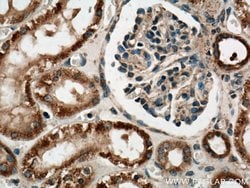 PYK2 Rabbit anti-Human, Mouse, Rat, Polyclonal, Proteintech 150 &mu;L;