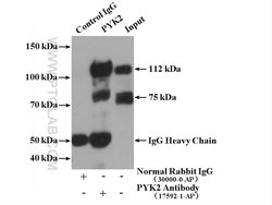 PYK2 Rabbit anti-Human, Mouse, Rat, Polyclonal, Proteintech 150 &mu;L;