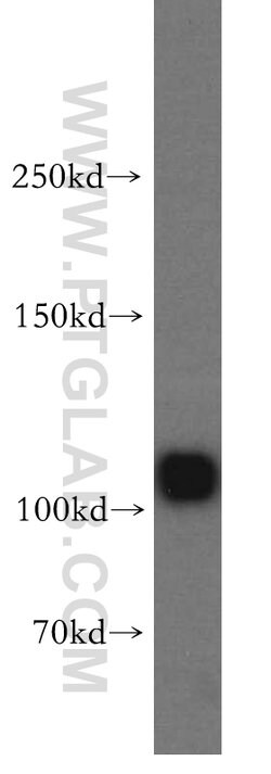 PYK2 Rabbit anti-Human, Mouse, Rat, Polyclonal, Proteintech 150 &mu;L;