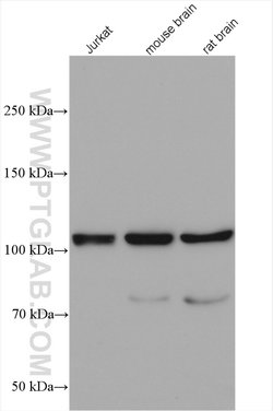 PYK2 Rabbit anti-Human, Mouse, Rat, Polyclonal, Proteintech 150 &mu;L;