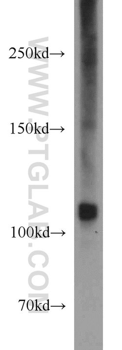 PYK2 Rabbit anti-Human, Mouse, Rat, Polyclonal, Proteintech 150 &mu;L;