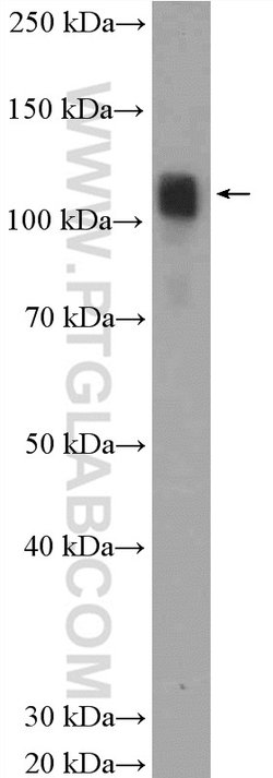 PYK2 Rabbit anti-Human, Mouse, Rat, Polyclonal, Proteintech 150 &mu;L;
