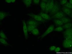 FIGNL1 Rabbit anti-Human, Mouse, Rat, Polyclonal, Proteintech:Antibodies:Primary