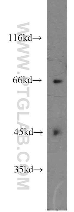 FIGNL1 Rabbit anti-Human, Mouse, Rat, Polyclonal, Proteintech:Antibodies:Primary