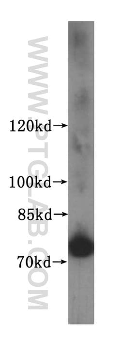 FIGNL1 Rabbit anti-Human, Mouse, Rat, Polyclonal, Proteintech:Antibodies:Primary