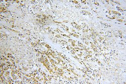 AKT2 Rabbit anti-Human, Mouse, Rat, Polyclonal, Proteintech:Antibodies:Primary