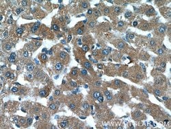 AKT2 Rabbit anti-Human, Mouse, Rat, Polyclonal, Proteintech:Antibodies:Primary