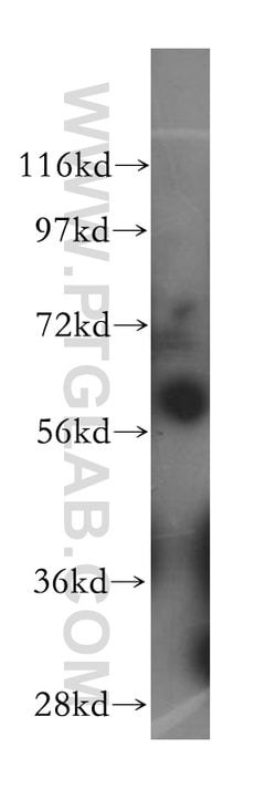 HEMGN Rabbit anti-Human, Mouse, Polyclonal, Proteintech 150 μL; Unconjugated:Antibodies,