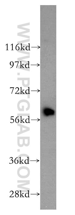 HEMGN Rabbit anti-Human, Mouse, Polyclonal, Proteintech 150 μL; Unconjugated:Antibodies,