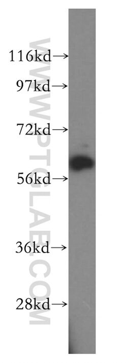 HEMGN Rabbit anti-Human, Mouse, Polyclonal, Proteintech 150 μL; Unconjugated:Antibodies,