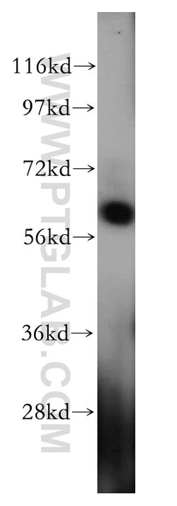 HEMGN Rabbit anti-Human, Mouse, Polyclonal, Proteintech 150 μL; Unconjugated:Antibodies,