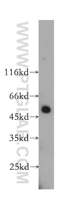 HEMGN Rabbit anti-Human, Mouse, Polyclonal, Proteintech 150 μL; Unconjugated:Antibodies,