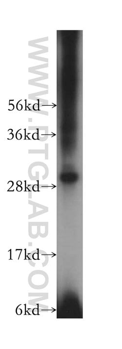SBDS Rabbit anti-Human, Mouse, Rat, Polyclonal, Proteintech 150 &mu;L;