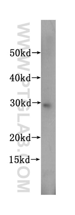 SBDS Rabbit anti-Human, Mouse, Rat, Polyclonal, Proteintech 150 &mu;L;