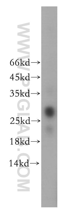 GSTT2B Rabbit anti-Human, Mouse, Rat, Polyclonal, Proteintech 20 &mu;L; Unconjugated 