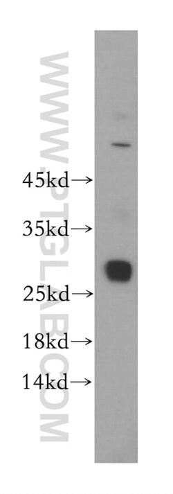 GSTT2B Rabbit anti-Human, Mouse, Rat, Polyclonal, Proteintech 20 &mu;L; Unconjugated 