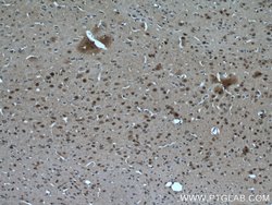 RORB Rabbit anti-Human, Mouse, Rat, Polyclonal, Proteintech 150 &mu;L;