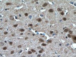 RORB Rabbit anti-Human, Mouse, Rat, Polyclonal, Proteintech 150 &mu;L;