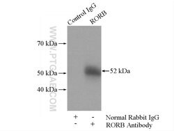 RORB Rabbit anti-Human, Mouse, Rat, Polyclonal, Proteintech 150 &mu;L;