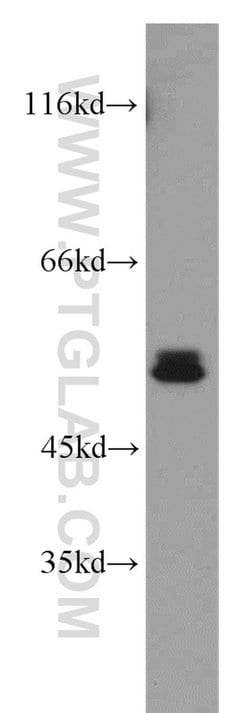 RORB Rabbit anti-Human, Mouse, Rat, Polyclonal, Proteintech 150 &mu;L;