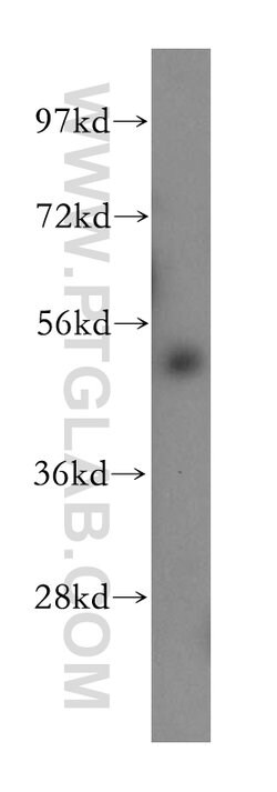 RORB Rabbit anti-Human, Mouse, Rat, Polyclonal, Proteintech 150 &mu;L;
