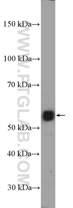 RORB Rabbit anti-Human, Mouse, Rat, Polyclonal, Proteintech 150 &mu;L;