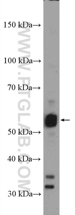 RORB Rabbit anti-Human, Mouse, Rat, Polyclonal, Proteintech 150 &mu;L;