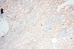 EHBP1 Rabbit anti-Human, Mouse, Rat, Polyclonal, Proteintech 150 &mu;L;
