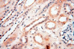 EHBP1 Rabbit anti-Human, Mouse, Rat, Polyclonal, Proteintech 150 &mu;L;