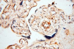 EHBP1 Rabbit anti-Human, Mouse, Rat, Polyclonal, Proteintech 150 &mu;L;