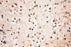EHBP1 Rabbit anti-Human, Mouse, Rat, Polyclonal, Proteintech 150 &mu;L;