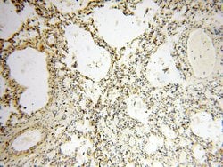 EHBP1 Rabbit anti-Human, Mouse, Rat, Polyclonal, Proteintech 150 &mu;L;