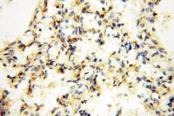 EHBP1 Rabbit anti-Human, Mouse, Rat, Polyclonal, Proteintech 150 &mu;L;
